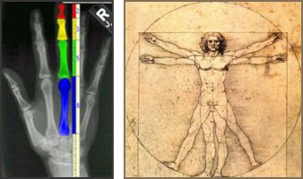 X-ray of hand, and Vitruvian Man by Leonardo Da Vinci